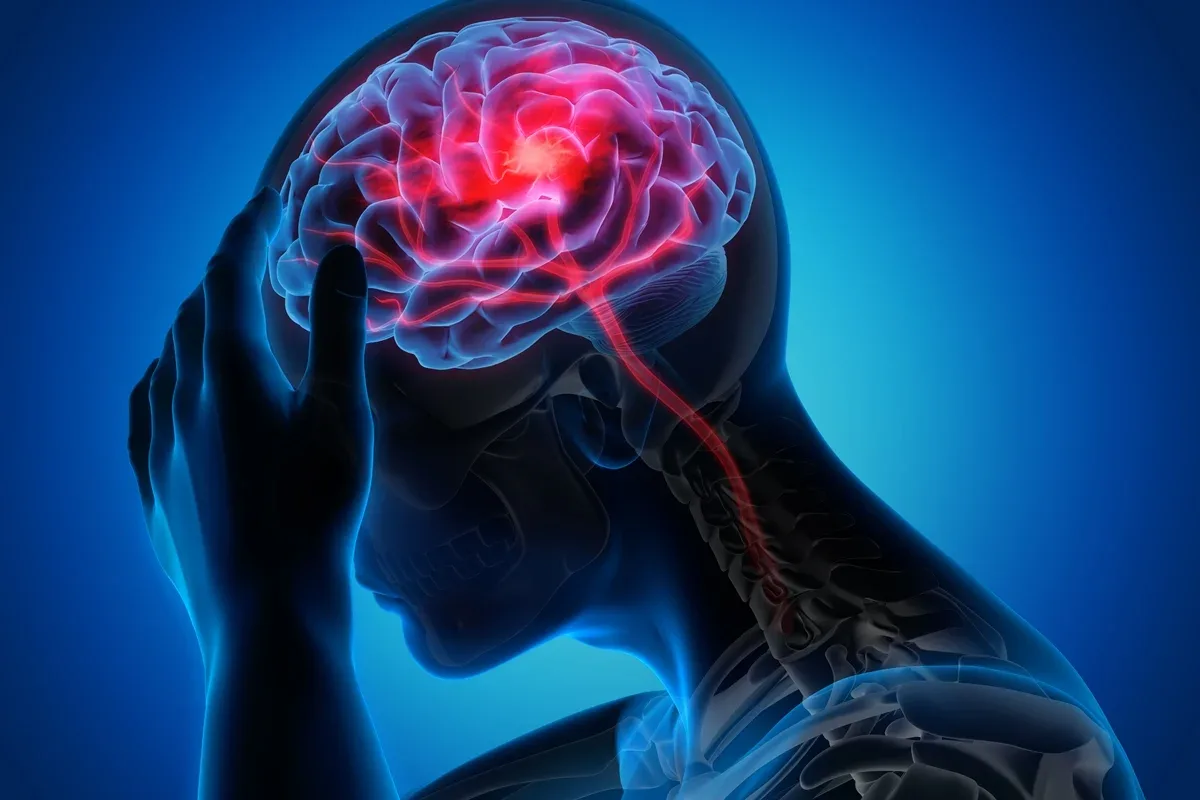Biomaterial injetável estimula reparo cerebral após AVC em testes com animais