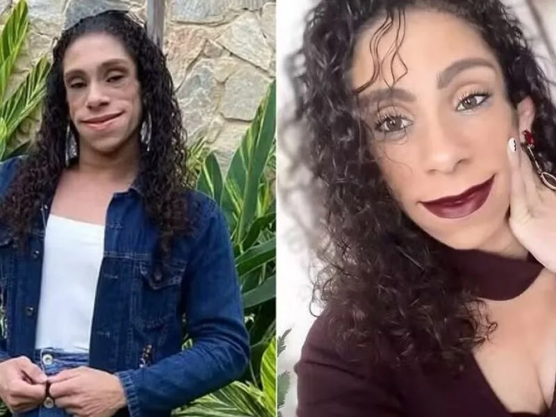 Doença rara faz Karyn Cerqueira viver sem gordura aparente