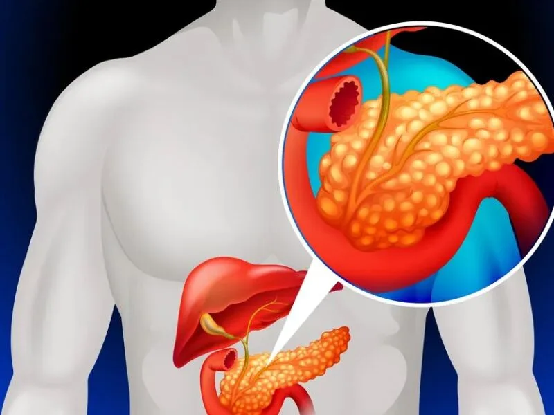 Exame de sangue experimental identifica câncer de pâncreas em fases iniciais
